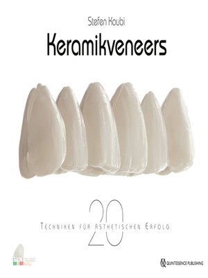 cover image of Keramikveneers